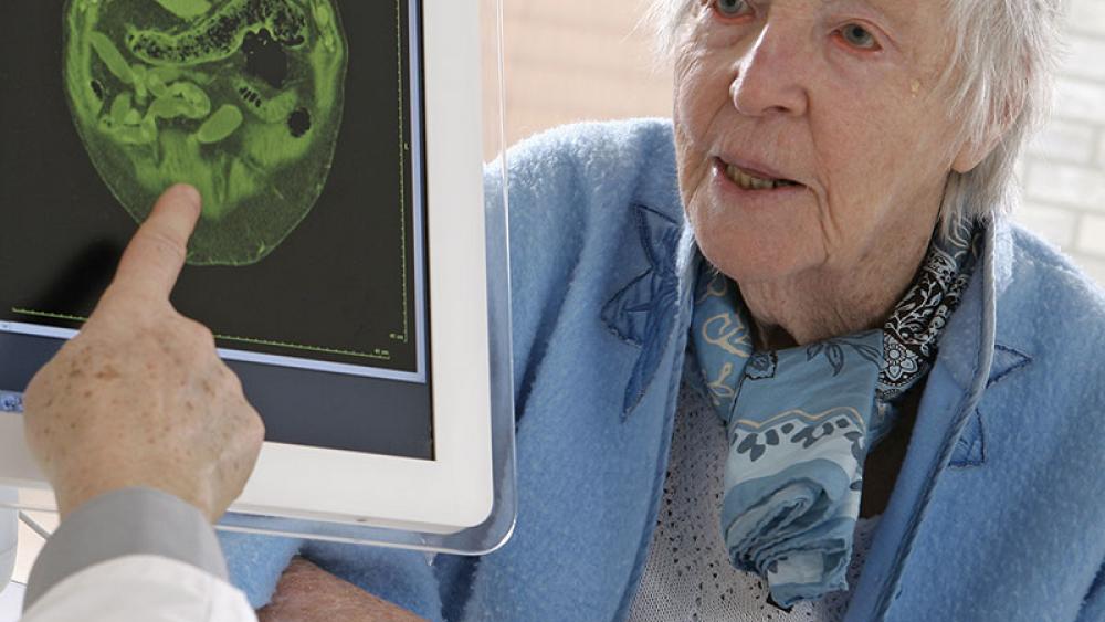 Стадии болезни Альцгеймера: от первых симптомов до поздних стадий - как обеспечить качественный уход и когда стоит рассмотреть пансионат